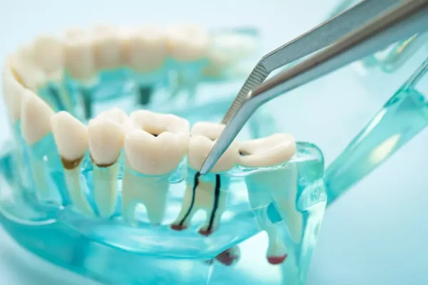 dental-teeth-model-with-dentist-tool-for-dentistry-2026-01-09-11-53-21-utc.webp